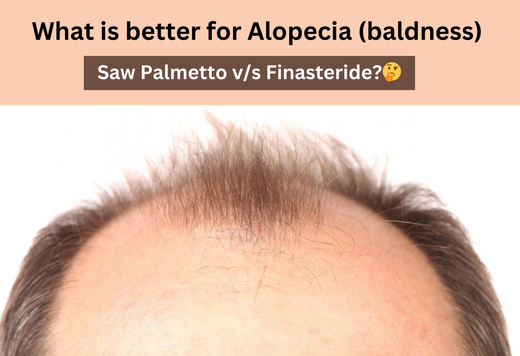 What is better for Alopecia (baldness) Saw Palmetto v/s finasteride?