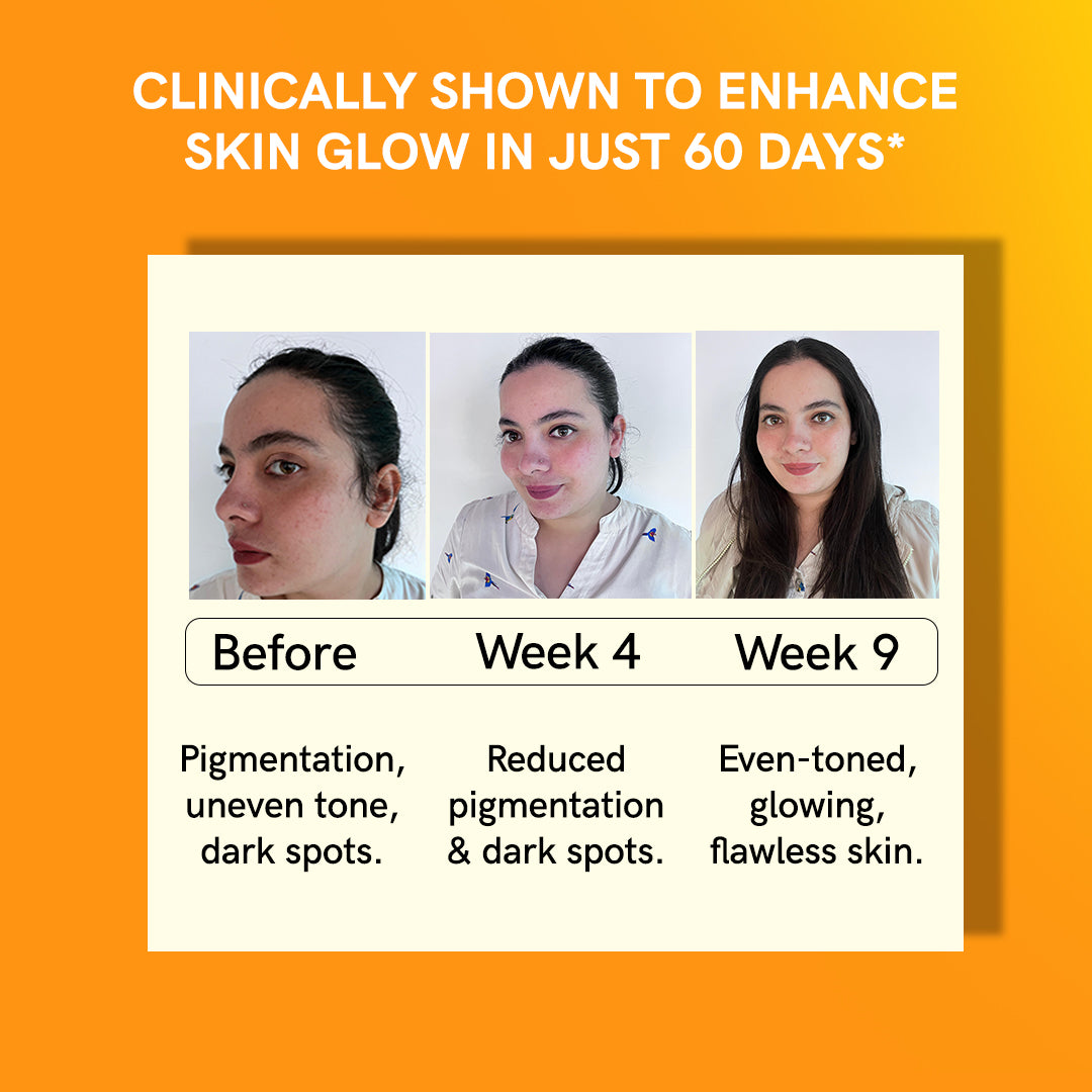 Skin Glow L-Glutathione Effervescent Tablets with Vitamin C Supplement for Radiant Skin (15 Tablets)